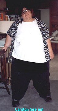 Carston (pre-op)